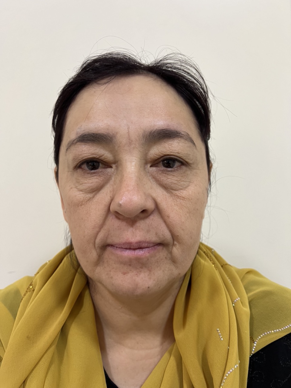 Результат работы 10 (до)