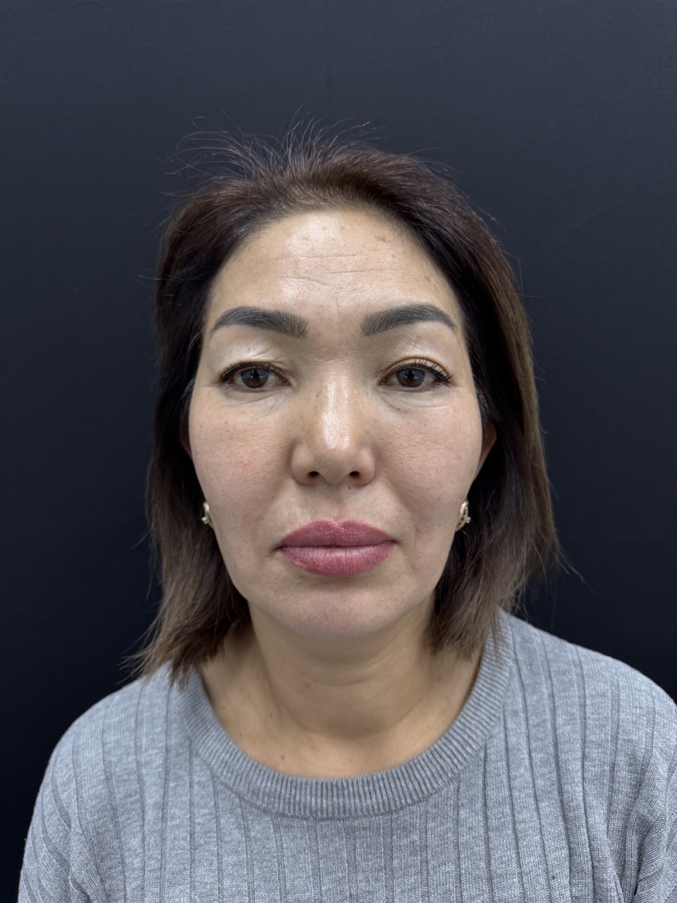 Результат работы 1 (после)