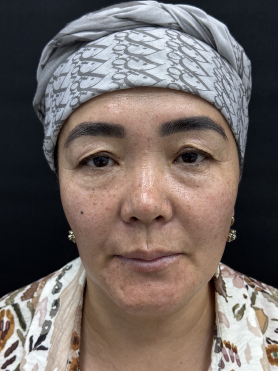 Результат работы 4 (до)