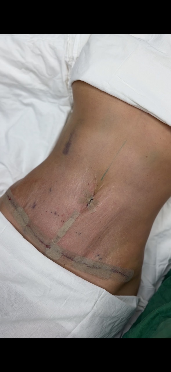 Результат работы 5 (до)